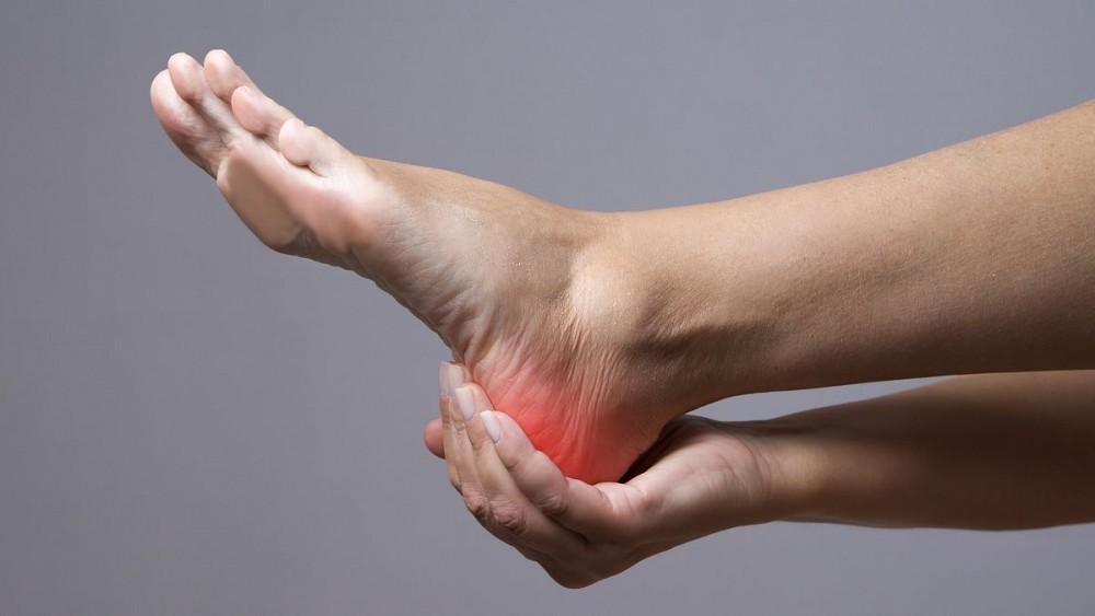 This Common Foot Problem Could Be the Real Cause of Your Knee Pain