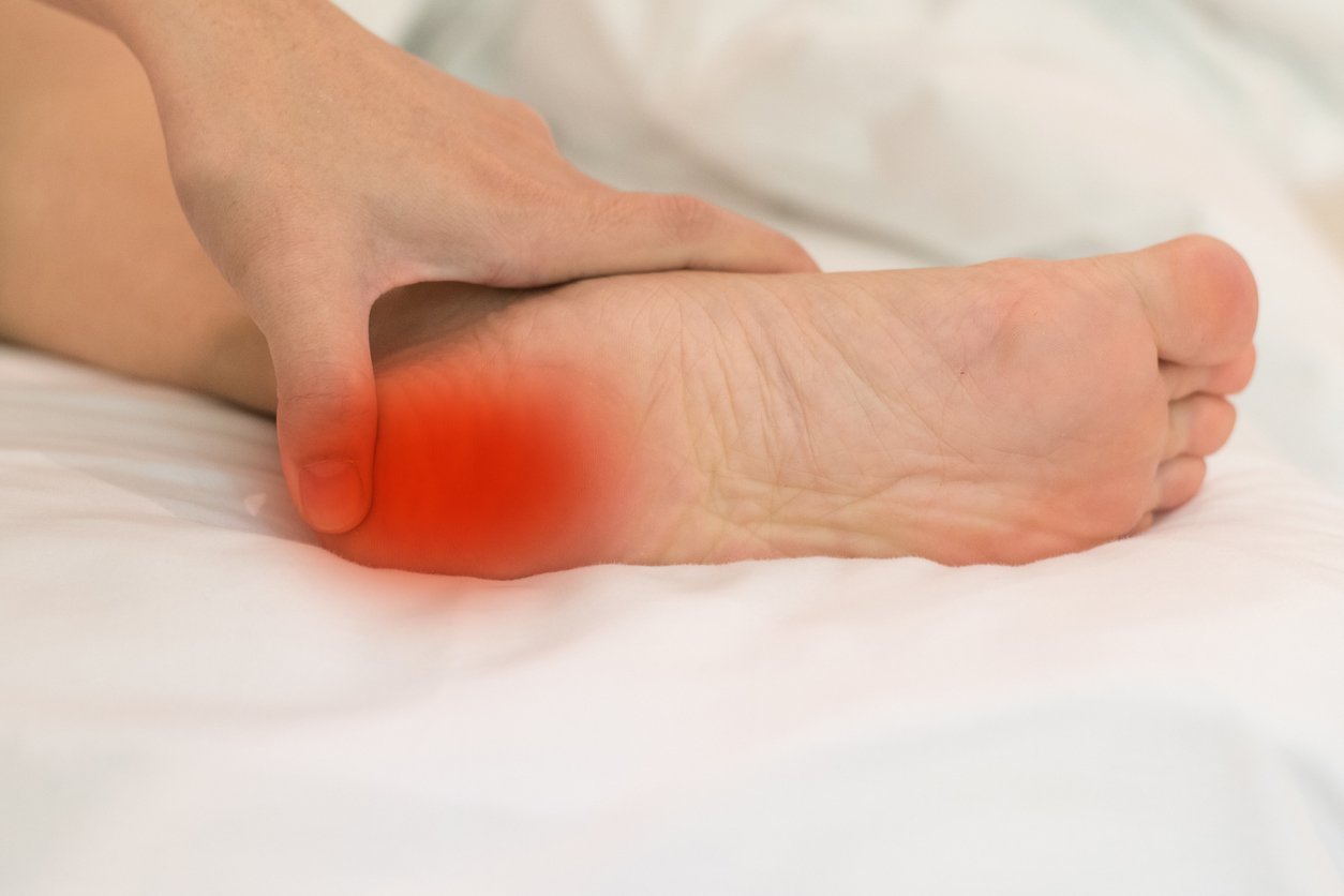 Ancient Pain Management and the Rise of Modern Plantar Fasciitis